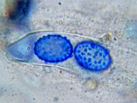 Scutellinia subhirtella 1, Broekboswimperzwam, Micro, Saxifraga-Lucien Rommelaars