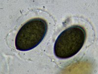 Sordaria fimicola 2, Micro, Saxifraga-Lucien Rommelaars