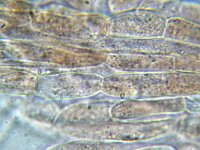 Agaricus subrufescens 11, Micro, Saxifraga-Lucien Rommelaars