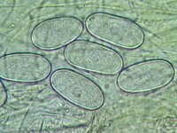 Ascobolus immersus 2, Slijmspoorspikkelschijfje, Micro, Saxifraga-Lucien Rommelaars