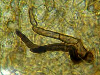 Capronia mansonii  4, Micro, Saxifraga-Lucien Rommelaars