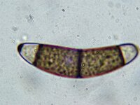 Chaetosphaerella phaeostroma