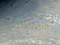 Chaetosphaeria cupulifera 2, Micro, Saxifraga-Lucien Rommelaars