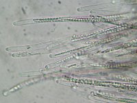 Cordyceps ophioglossoides 7, Zwarte truffelknotszwam, Micro, Saxifraga-Lucien Rommelaars