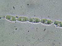 Diaporthe sp 2, Prunus spinosa, Micro, Saxifraga-Lucien Rommelaars