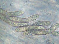 Echinosphaeria canescens 2, Bruingrijs ruigkogeltje,  Micro, Saxifraga-Lucien Rommelaars