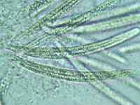 Gaeumannomyces graminis