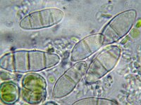 Gibberella sp 2, Micro, Saxifraga-Lucien Rommelaars