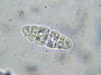 Gloniopsis praelonga