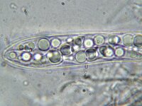 Trematosphaeria pertusa 4, Micro, Saxifraga-Lucien Rommelaars