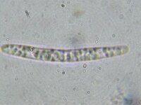 Chaetosphaeria cupulifera