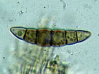 Lophiostoma arundinis 4, Micro, Saxifraga-Lucien Rommelaars