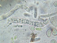 Lasiosphaeria caudata